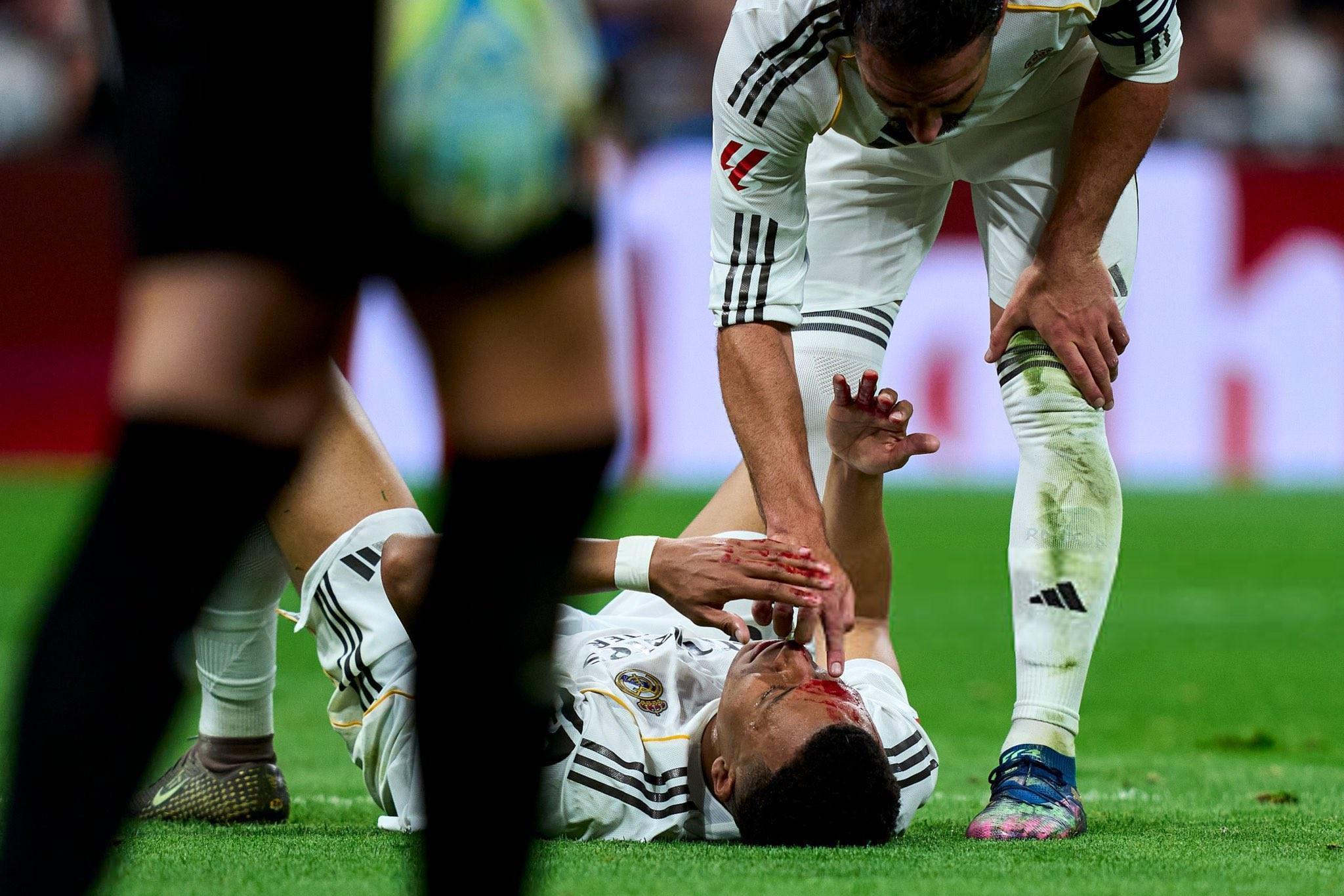 易游体育品牌-每体：姆巴佩被肘击未判点，皇马希望听取主裁和VAR沟通音频